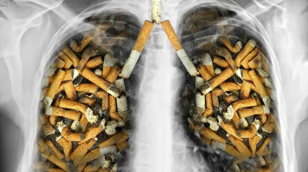 Estas son las principales causas del cáncer de pulmón