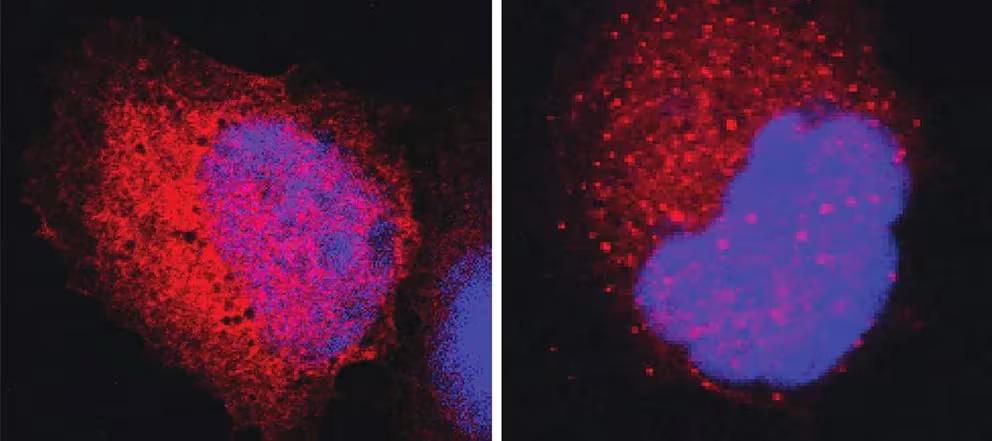 mecanismo contra cáncer proteínas tumorales 1