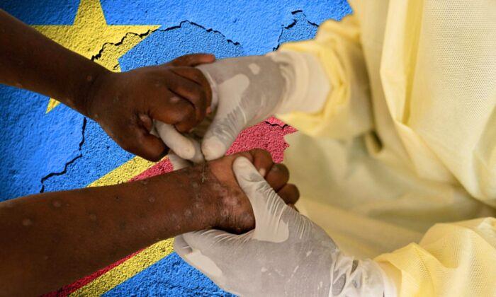 Tardan vacunas contra mpox en África