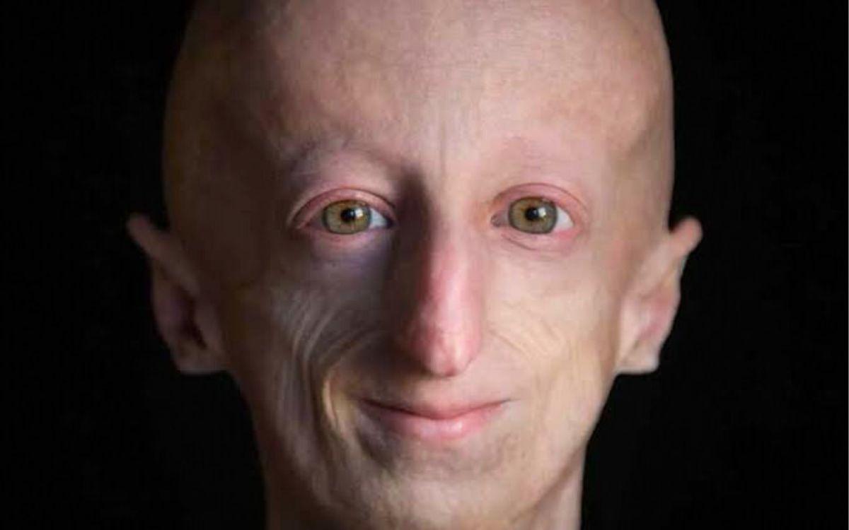 muerte científico Sammy Basso progeria