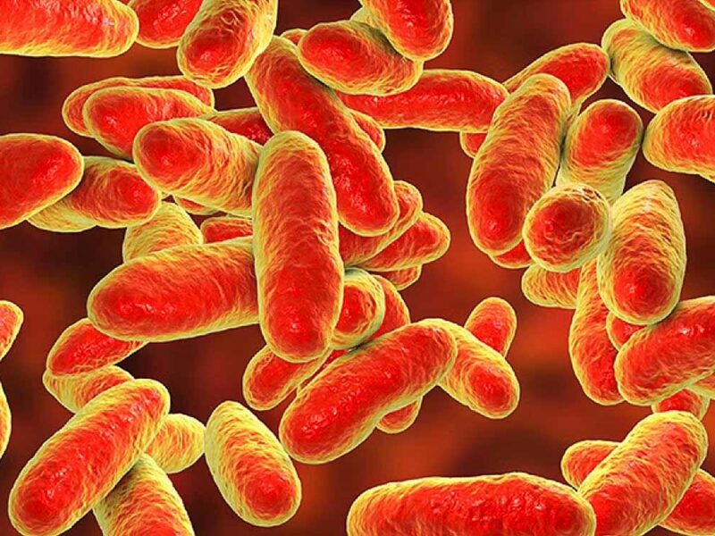 Resistencia bacteriana sería la principal causa de muerte en 2050: Especialista