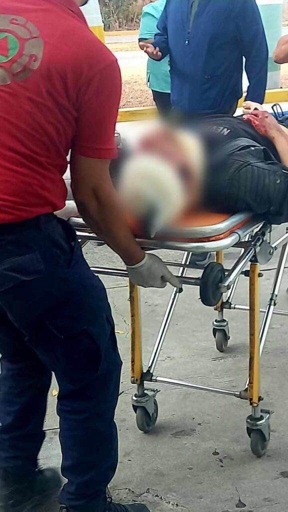 Joven resulta herido en accidente al derrapar en su motocicleta en la Apatzingán – Buenavista-2