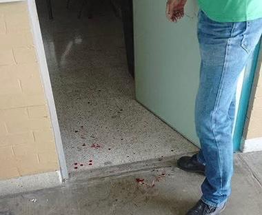 Ataque en CCH Naucalpan de la UNAM Estudiante agrede a profesor